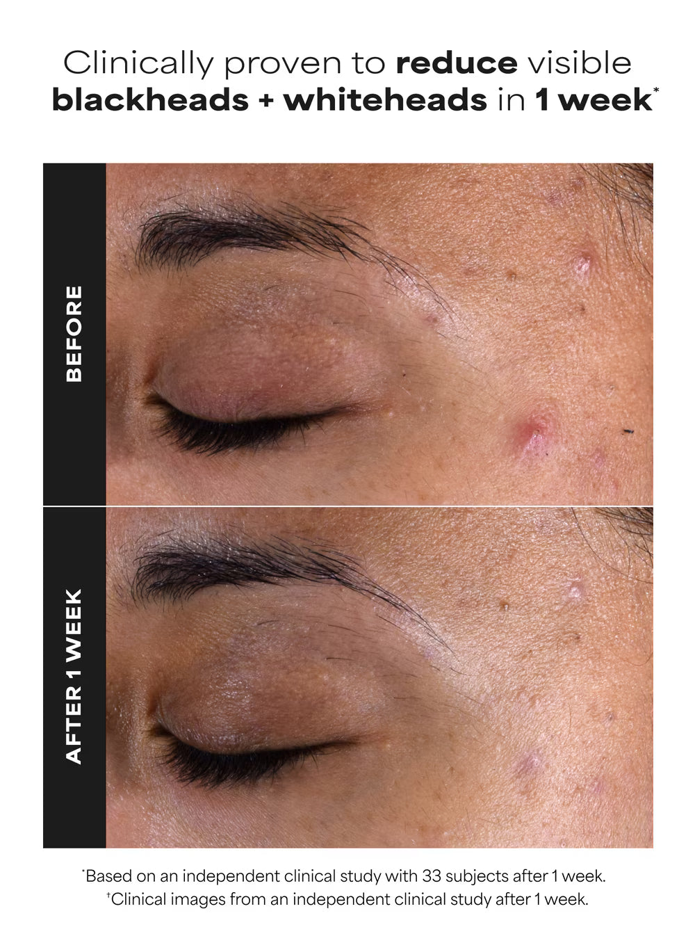 Paula’s Choice
2% BHA Liquid Exfoliant 🖤