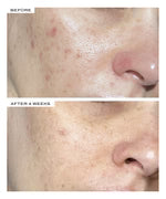 111SKIN    
REPAIR SERUM NAC Y²™ 🤍