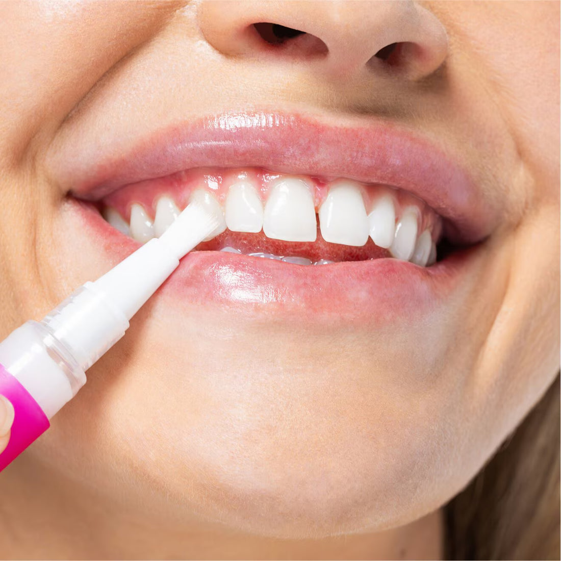 HISMILE (Teeth whitening)