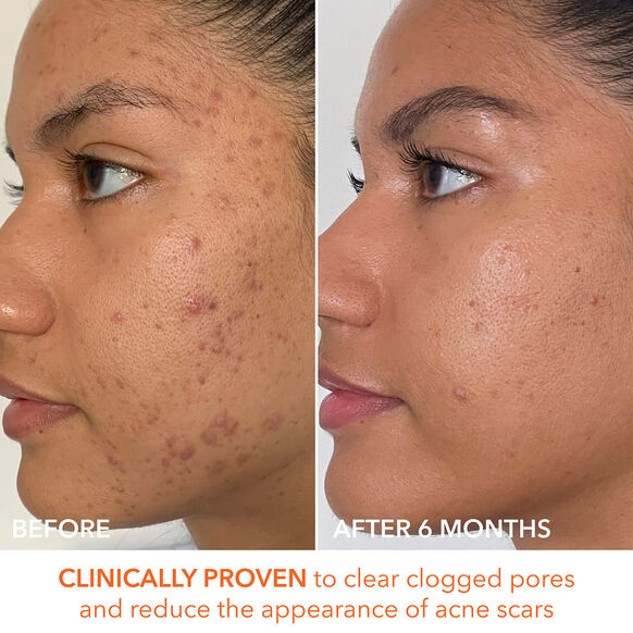 Dr.Dennis 
Gross Alpha Beta Peel Extra Strength Formula ♥️