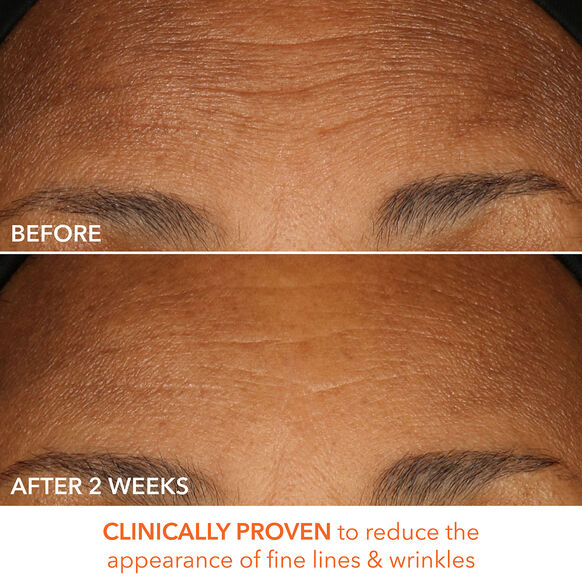 Dr.Dennis 
Gross Alpha Beta Peel Extra Strength Formula ♥️