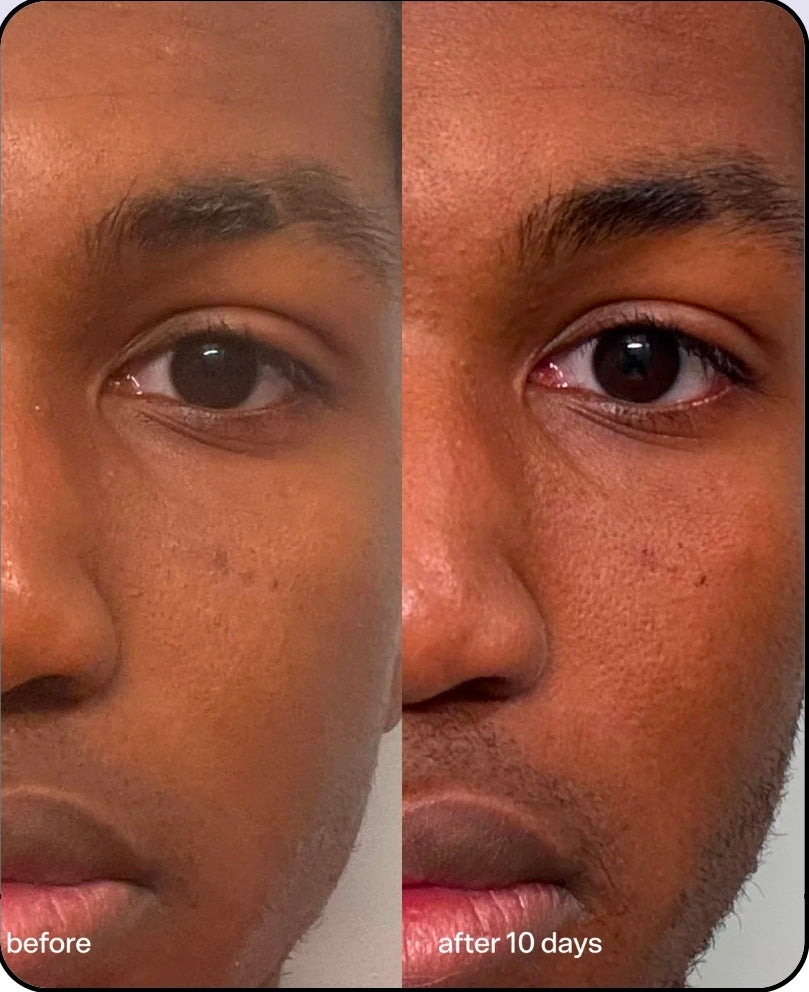 Bubble Star Dew
Hydrating Eye Cream ♥️