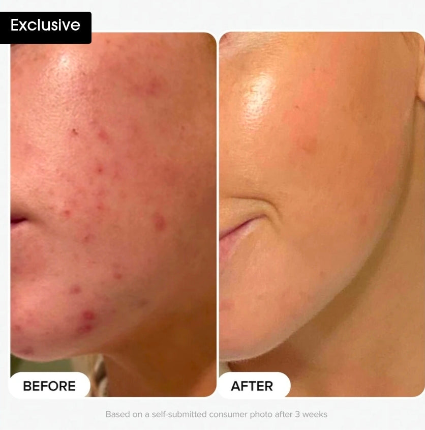 PAULA'S CHOICE
Skin Perfecting 2% BHA Liquid Exfoliant Toner