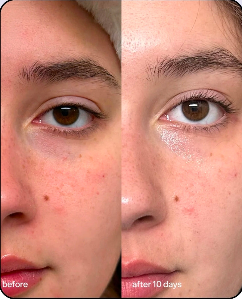 Bubble Star Dew
Hydrating Eye Cream ♥️