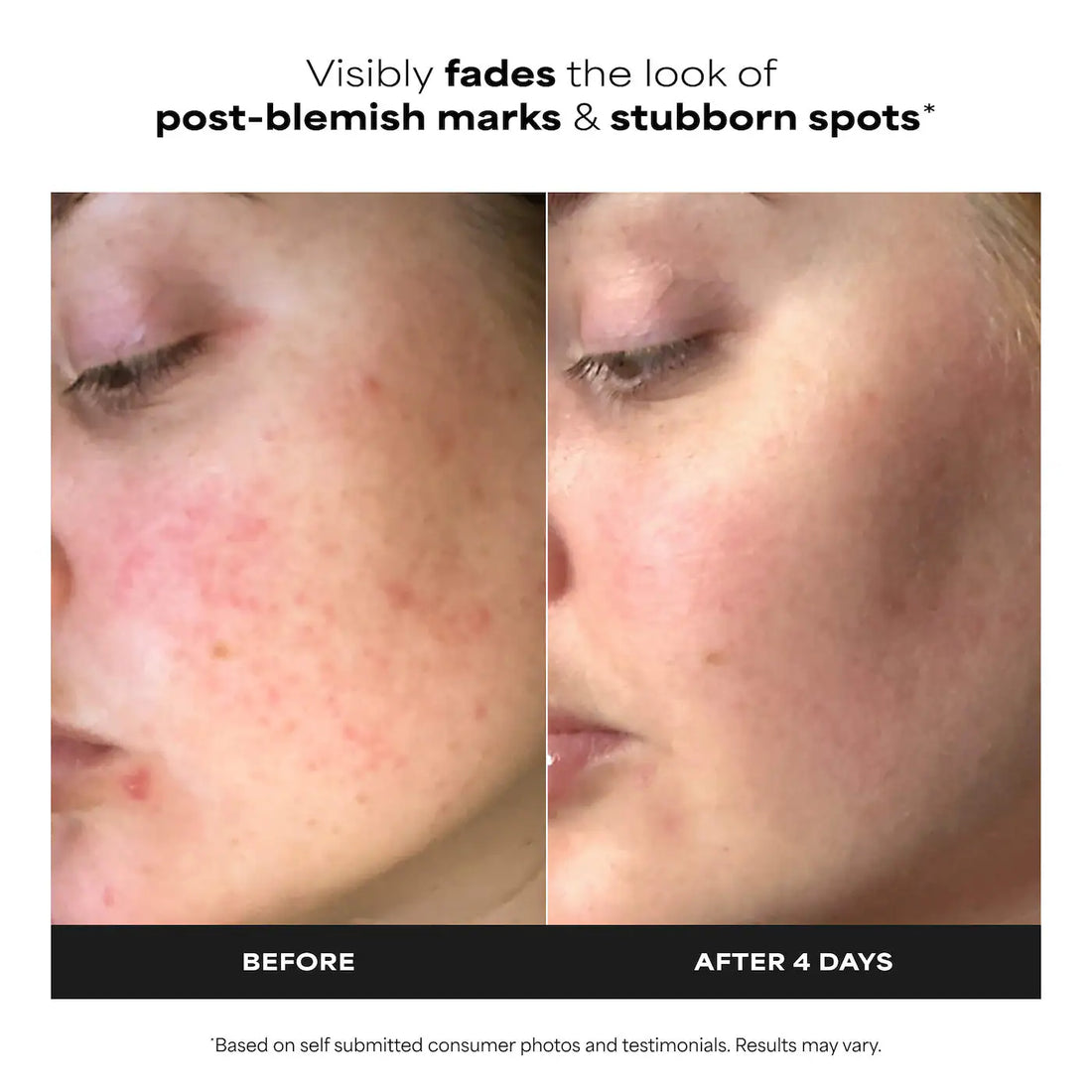 Paula's Choice    
10% Azelaic Acid Booster for Redness Relief 💚