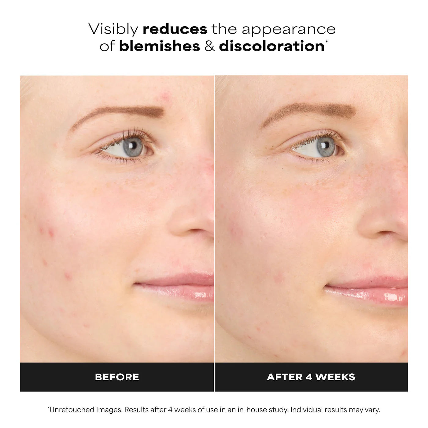 Paula's Choice    
10% Azelaic Acid Booster for Redness Relief 💚