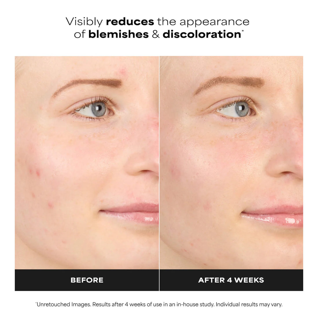 Paula's Choice    
10% Azelaic Acid Booster for Redness Relief 💚