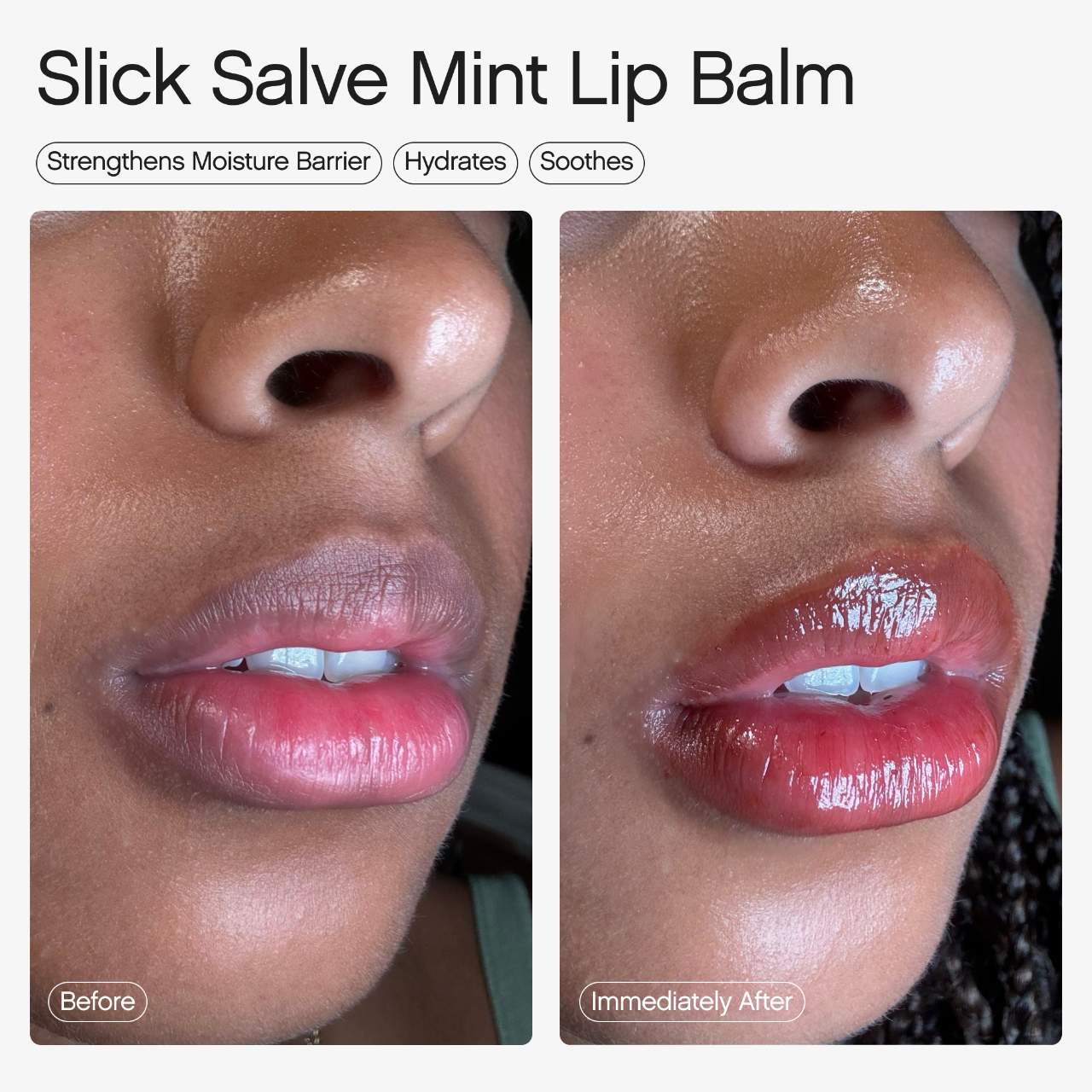 Topicals  
Slick Salve Glossy Lip Balm for Soothing + Hydration 💚✔️